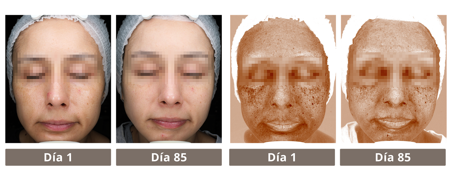 Doble Serum
